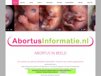 Abortusinformatie.nl