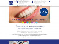 dental-vision.nl
